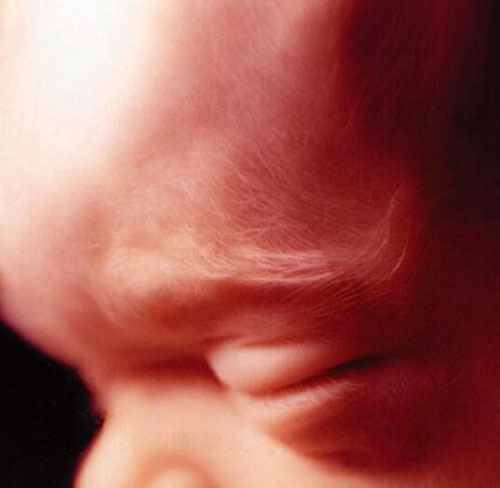 Những bức ảnh siêu âm rõ từng centimet khiến bác sĩ cũng phải giật mình - 6