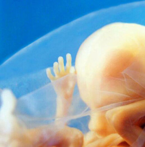 Những bức ảnh siêu âm rõ từng centimet khiến bác sĩ cũng phải giật mình - 9