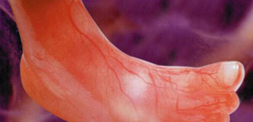 Những bức ảnh siêu âm rõ từng centimet khiến bác sĩ cũng phải giật mình - 8