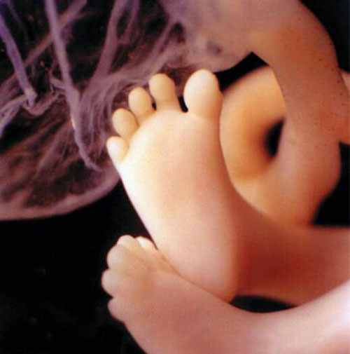 Những bức ảnh siêu âm rõ từng centimet khiến bác sĩ cũng phải giật mình - 7