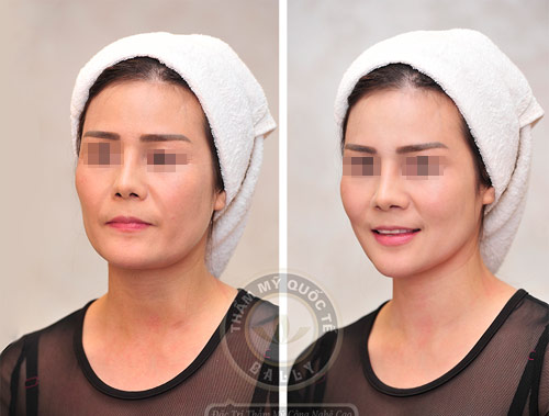 Vén màn bí quyết “trẻ mãi không già” của người nổi tiếng - 5