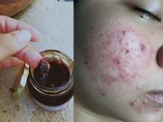 Làm đẹp - Giật mình sau 3 ngày không còn nhận ra mình với cao bí đao siêu rẻ