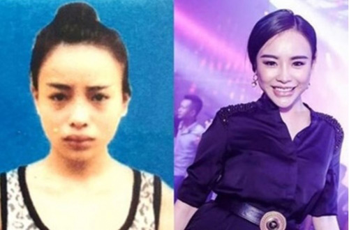 Hot girl phẫu thuật trốn truy nã bị bắt khi đang tổ chức sinh nhật kỳ dị - 1