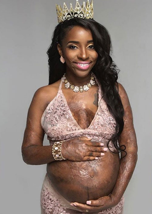 Ngại sinh con, hãy đọc ngay 4 câu chuyện tạo cảm hứng mãnh liệt này! - 3