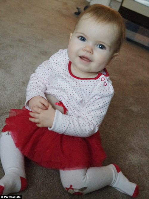 Sinh ra với amp;#34;ruột để ngoài daamp;#34; nhưng em bé này đã lớn lên đáng yêu không ngờ - 5