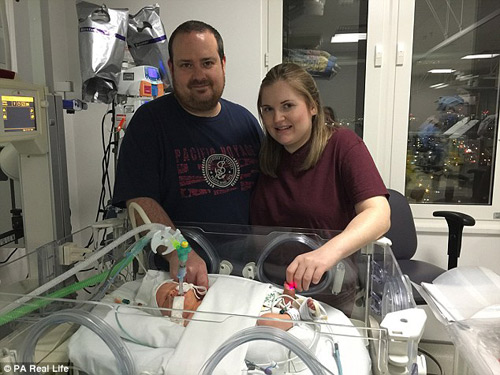 Sinh ra với amp;#34;ruột để ngoài daamp;#34; nhưng em bé này đã lớn lên đáng yêu không ngờ - 1