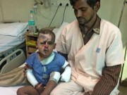 Tin tức - Bé trai 2 tuổi bị biến dạng nửa khuôn mặt vì bị người theo đuổi mẹ tạt axit