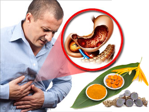 Tại sao uống nghệ đều nhưng dạ dày vẫn đau? - 1