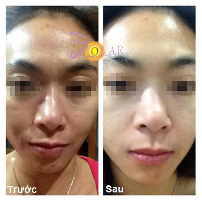 Da mặt trắng mịn, căng bóng chỉ trong 90 phút - 3
