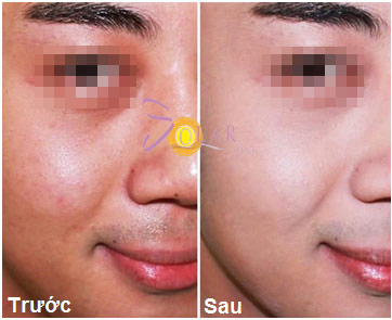 Da mặt trắng mịn, căng bóng chỉ trong 90 phút - 4
