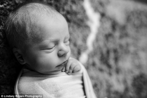 Nhói tim với ảnh em bé đang cận kề cái chết ôm chị gái song sinh vừa chào đời - 6