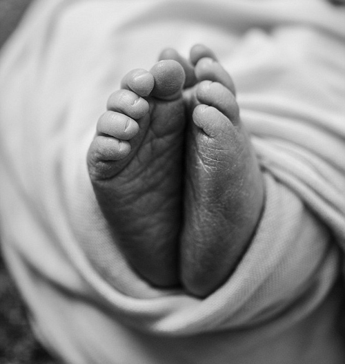 Nhói tim với ảnh em bé đang cận kề cái chết ôm chị gái song sinh vừa chào đời - 7