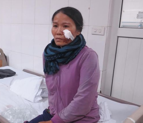 Lật xe ở Nghệ An 14 người nhập viện: Hành khách kể lại giây phút sinh tử - 2