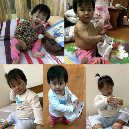Mẹ 8x chia sẻ kinh nghiệm cùng 2 con amp;#39;chiến đấuamp;#39; với dịch thuỷ đậu - 2