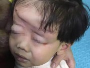 Tin tức - Mẹ mải xem điện thoại, con 4 tuổi bị xe đạp điện trong khu vui chơi cán qua đầu biến dạng