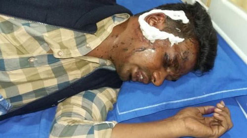 Nữ y tá tạt axit và rạch mặt người yêu cũ vì bỏ đi lấy vợ - 2