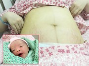 Bà bầu - Nhật ký đẻ mổ "run đùng đùng đến nỗi chỉ sợ chết" của mẹ trẻ 9x xinh đẹp