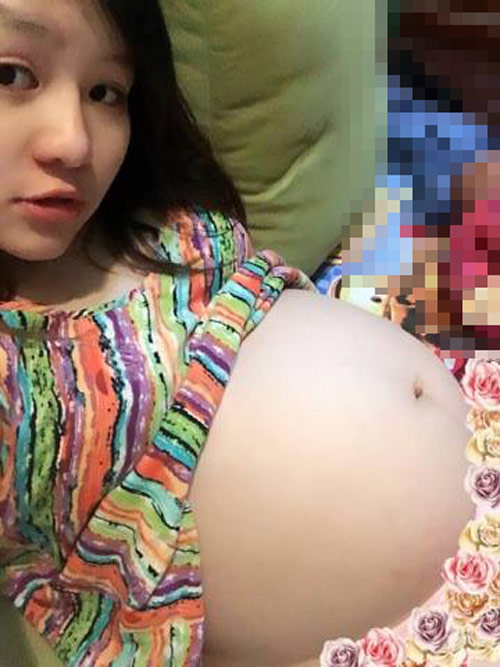 Nhật ký đẻ mổ amp;#34;run đùng đùng đến nỗi chỉ sợ chếtamp;#34; của mẹ trẻ 9x xinh đẹp - 5