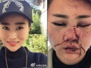 Tin tức - Cô gái xinh đẹp bị chục người đàn ông say rượu đánh đập, lấy vỏ chai bia rạch nát mặt
