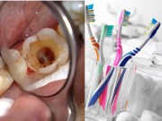 Làm đẹp - 90% trong số chúng ta mắc phải thói quen này, đừng hỏi tại sao răng xấu và yếu