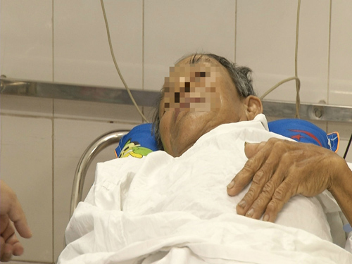 Hy hữu: Cụ ông nguy kịch vì bị xương gà đâm thấu vào vùng tim - 2