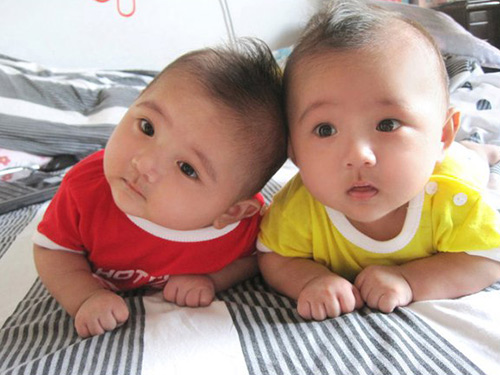 Cặp song sinh đẹp như thiên thần có 7 nghìn người theo dõi, khi lớn còn gây ngỡ ngàng hơn - 2