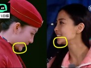 Làng sao - Ngôi sao 24/7: "Kẻ cướp chồng của Dương Mịch" lộ cằm gẫy