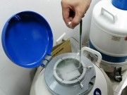 Tin tức - Vừa vô sinh lại ung thư gan, người chồng quyết tâm gửi tinh trùng và cái kết bất ngờ