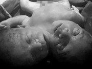 Tin tức - Mẹ chết ngất khi con tử vong sau sinh bởi dị tật dù siêu âm thai bình thường