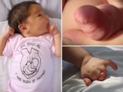 Bà bầu - Siêu âm 22 tuần, mẹ bàng hoàng phát hiện chân tay con không có ngón