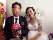 Eva Yêu - Chuyện tình cổ tích của người đẹp khuyết tật và chàng trai có khối u dị biệt