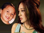 Làm đẹp - Bảo Anh tự tin khoe ảnh hồi nhỏ, phản pháo tin đồn nâng mũi