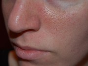 Làm đẹp - Lỗ chân lông to đến đâu cũng se khít nhờ vài ngàn tiền mặt nạ