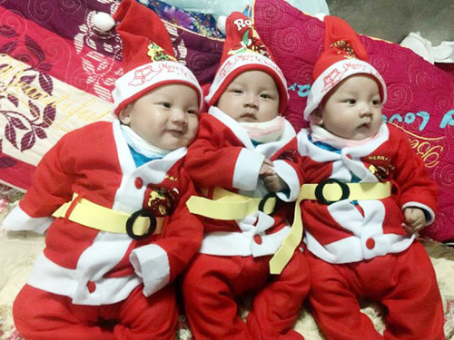 3 ca sinh con nằm trong bọc ối hy hữu tại Việt Nam khiến bác sĩ ngỡ ngàng - 2