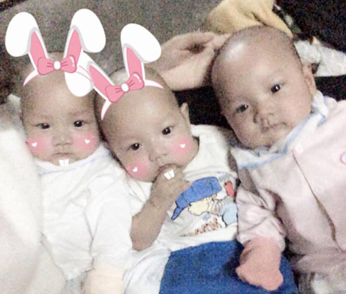 3 ca sinh con nằm trong bọc ối hy hữu tại Việt Nam khiến bác sĩ ngỡ ngàng - 3