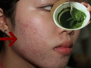 Làm đẹp - 99% bạn gái không biết những "điều cấm" này dù đắp mặt nạ bột trà xanh mỗi ngày