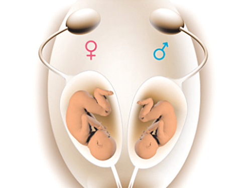 Giới tính của thai nhi hình thành như thế nào trong bụng mẹ? - 1