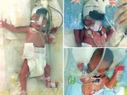 Bà bầu - Mang 3 thai, bà mẹ đã có ca đẻ thường “khác người” như thế này!
