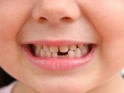 Làm mẹ - Tại sao nha sĩ khuyên cất giữ răng sữa của trẻ để khi cần có thể cứu mạng con?