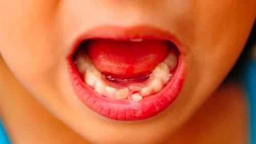 Tại sao nha sĩ khuyên cất giữ răng sữa của trẻ để khi cần có thể cứu mạng con