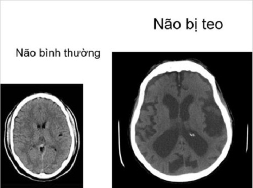 Rủ con uống rượu từ năm 13 tuổi, sau 5 năm người bố biết được sự thật đã muộn màng - 2