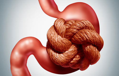 Không phải đau bụng, 5 dấu hiệu này cũng cảnh báo bạn đang đau ruột thừa - 2