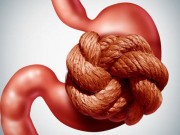 Sức khỏe - Không phải đau bụng, 5 dấu dấu hiệu này cũng cảnh báo bạn đang đau ruột thừa