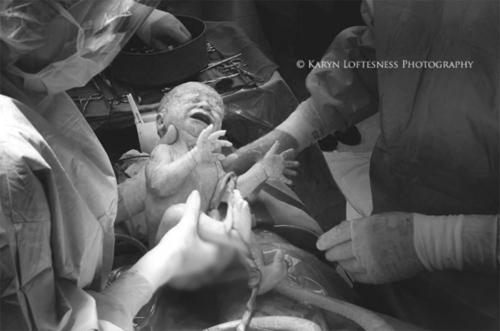 Ai nói sinh mổ là không biết đẻ, hãy xem ngay những bức ảnh này! - 15