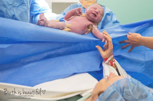 Ai nói sinh mổ là không biết đẻ, hãy xem ngay những bức ảnh này! - 7