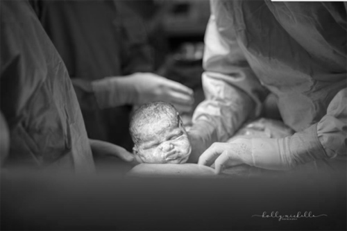 Ai nói sinh mổ là không biết đẻ, hãy xem ngay những bức ảnh này! - 10