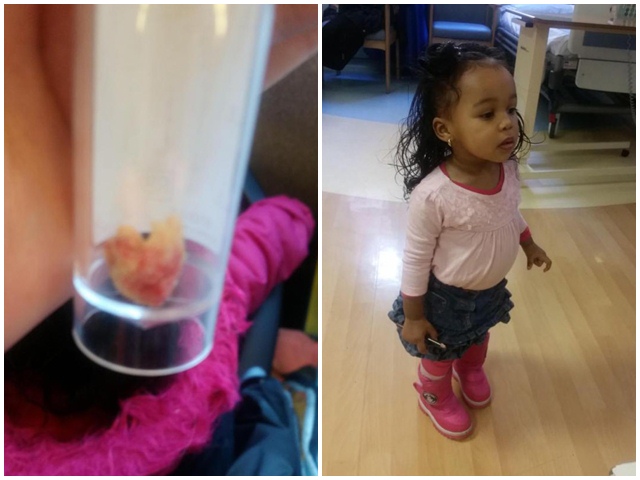 Bé 18 tháng có mùi hôi không ai chịu nổi, mẹ bàng hoàng khi biết nguyên nhân