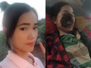 Tin tức - Tin tức 24h nổi bật: Sững sờ với lý do khiến cô gái trẻ bị phá hủy khuôn mặt sau nhổ răng