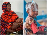 Tin tức - Xót xa nơi những đứa trẻ sinh ra đã được đào sẵn 'huyệt mộ'