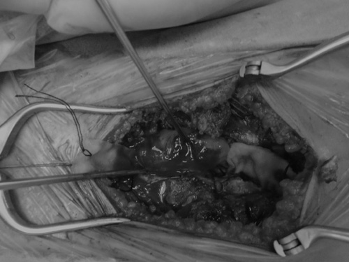 Chủ quan với cơn đau lưng âm ỉ, cô gái trẻ “chết lặng” khi bác sỹ đọc kết quả - 1